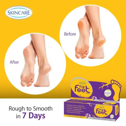Fair Feet cream 